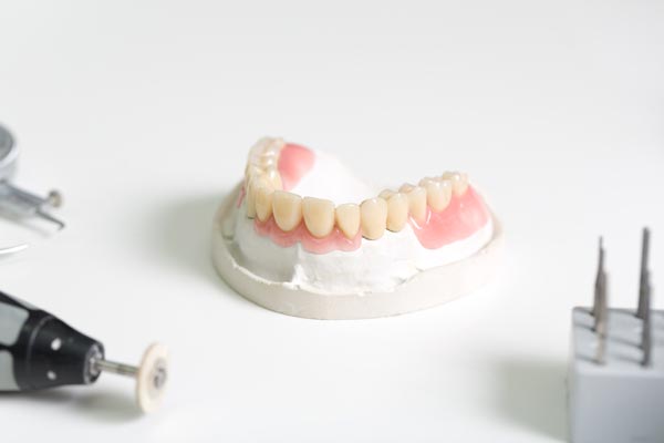 Zahnersatz von Dr. Stephanie Flaig, Zahnärztin München